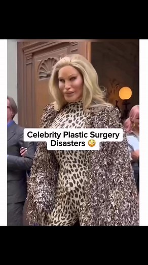 Plastic surgery gone wrong #viral #reelschallengereelschallenge #foryoupagereels | Ene Onazi | Facebook