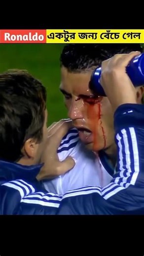 Ronaldo একটুর জন্য বেছে গেলেন, দেখে নিন কিভাবে? #facts #nubelbro