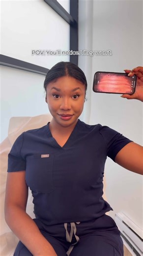 Experience the Magic of Botox at SpaMedica Toronto