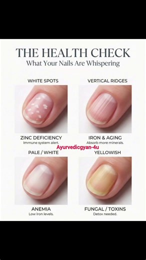 THE HEALTH CHECK ✅ WHAT YOUR NAIL WISHPERING #shorts#nailhealth#health#nailsymptoms#disease