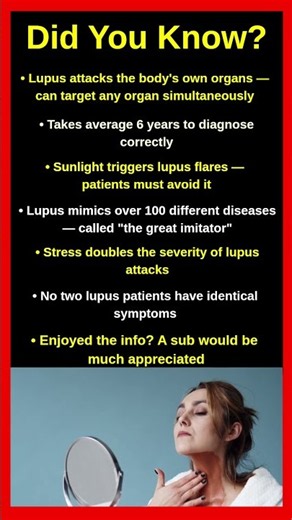 The Shocking Truth About Lupus Nobody Tells You 🩺⚠️😱