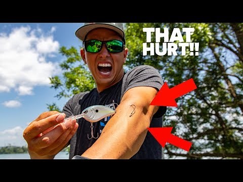 EASIEST HOOK REMOVAL TRICK...I HOOKED MYSELF TO PROVE IT! ( How to remove a fish hook )