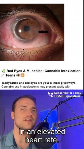 Step 1 - How to tell if someone is smoking pot