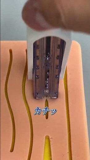 医療用ホッチキスのご紹介!?