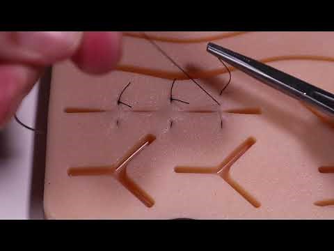 Vertical Mattress Suture Technique