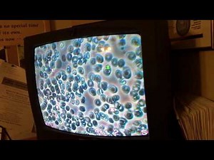 Aulterra Dark Field Microscopy