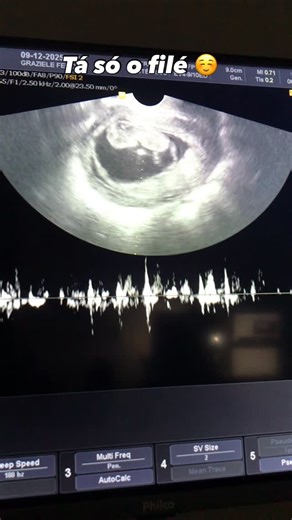 Osnar on Instagram: "Só filé 🙆🏻#rels #status #bebê"