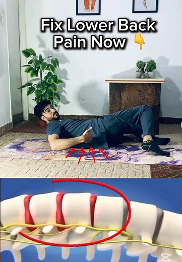 Effective Stretches for Lower Back Pain Relief