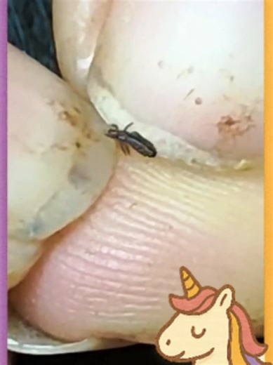 Effective Lice Treatment Options for Quick Relief