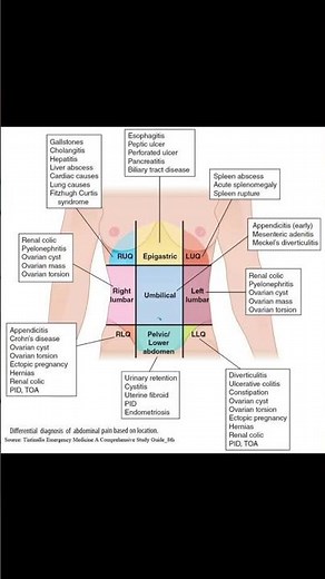 Abdominal Pain Localization – Regional Anatomy & Differential Diagnosis Chart