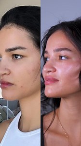 68K views · 539 reactions | Hooded eyes gone within DAYS What do...