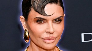 You won't recognize Lisa Rinna before all the extreme lip and face filler