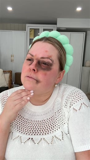 Selena Marchand on Instagram: "Based on a true story… The bridal black eye, do you carry colour correction in your makeup kit? #weddingtiktok #bridalmakeup #bridalmakeupartist"