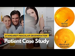 Stargardt & Macular Degeneration Treatment | Treatment for Centre Vision Loss | Patient Cast Study