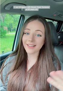 Mosaic Down Syndrome Diagnosis at 23: Personal Insight