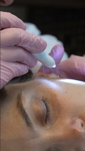 ASMR Medical Skin Check, Mole Mapping & Assessment [Face & Chest] #asmrrealperson #asmrrelax #relax