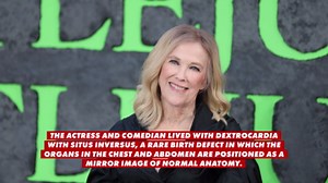 I spent $3K on a wedding photographer and these are the worst photos I’ve ever seen