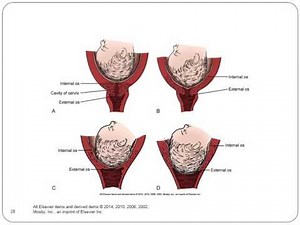 OB Chapter 013 Labor & Birth Process