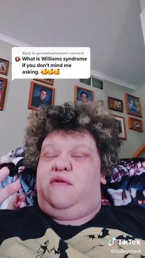 Understanding Williams Syndrome | Symptoms, Causes, and More