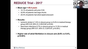 Update on PFO Closure: Overview of Trials and New Devices