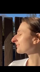 3.5K views · 19 reactions | How she looks after a nose job is unbelievable. Watch the full video in the comments below | The Amazing News | Facebook