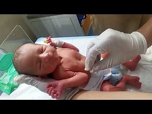 Newborn Baby Massage, Initial Assessment & Physiotherapy | Complete NICU Nursing Care 🩺