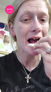 1.8K views | Cover missing teeth in an INSTANT like Amanda with...