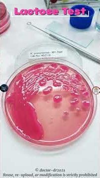 Klebsiella pneumoniae Biochemical Tests | Can You Identify This Bacterium? 🔬 #microbiologylab