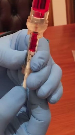 How To:Load medication from a vial with 14mm vial adapters