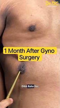 He Thought This Was the Right Gyno Massage Technique... It Wasn't! | Dr DC, Plastic Surgeon | India