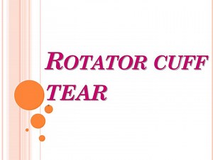 Rotator cuff tear - SlideServe