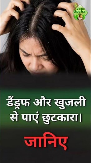 Stop Scalp Itching and Dandruff with Simple Home Remedies | Vedic Upchar | @anilbansalayurveda |