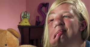 Doctors refused to touch Sarah's face - so she took matters into her own hands