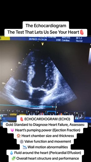 The Echocardiogram — The Test That Lets Us See Your Heart  An...