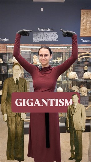 What causes someone to grow over 7 feet tall?🦴 In this video, we break down the difference between gigantism and acromegaly, two conditions caused by excess growth hormone—but at very different stages of life. From pituitary tumors to skeletal changes, discover how timing makes all the difference in how these conditions shape the human body. | The Bone Museum