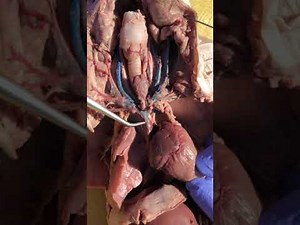 Fetal Pig Dissections 19: Circulation--Blood Vessels To From Heart Pulmonary Circuit