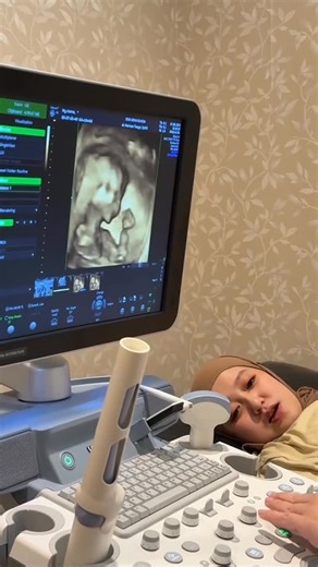 Wendy Ryan Jany Jr on Instagram: "adaaa aja gayanya tiap ketemu dede, gemesss 凉 #riansagit #usg #bumil"