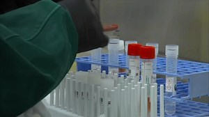 FDA warns about at-home COVID-19 test kit scams