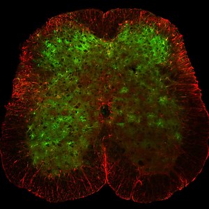Tiny microscopes reveal hidden role of nervous system cells - Salk Institute for Biological Studies