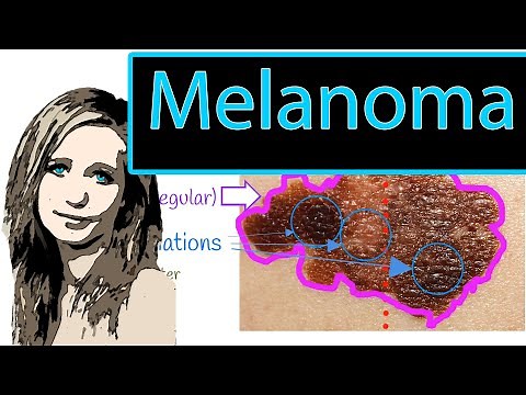Malignant Melanoma - How To detect Melanoma early; ABCDE rule. Types of Melanoma