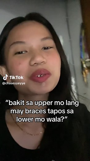 Braces Script Ideas and Upper Teeth Only Treatment