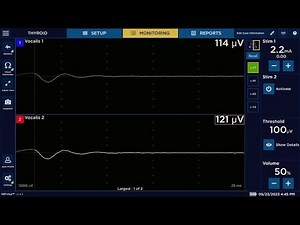 NIM Vital™ nerve monitoring system Set-up - Quick Tags