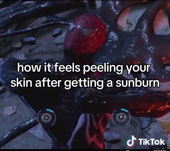 Understanding Skin Peeling After Sunburn