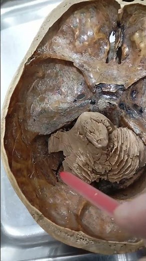 Posterior cranial fossa #anatomy #shorts #neuroanatomy #viralshrots