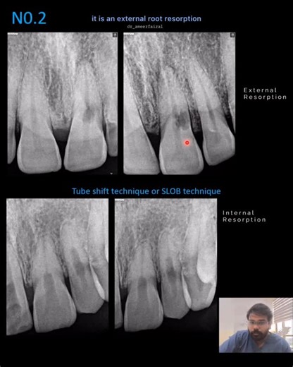 Ameer Faizal on Instagram: "Internal vs external ✌️!"