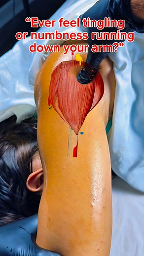 240K views · 127 reactions | “Ever feel tingling or numbness running...