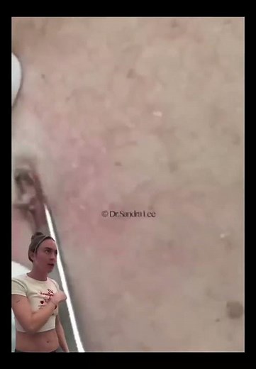 This is how I picture those of you that hate when I use my comedone extractor watching my videos!