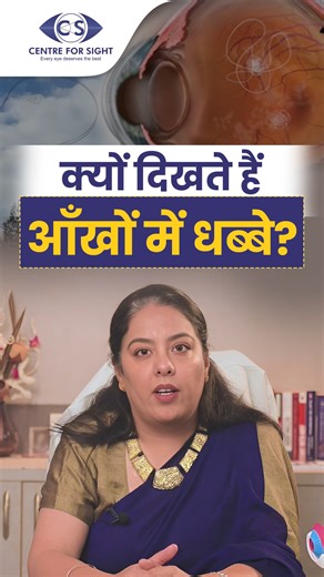 3.4K views · 50 reactions | Why Do You See Spots in Your Vision? |...