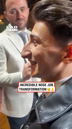 This transformation blew my mind 🤯🤩 #transformation #surgery #cosmeticsurgery | LADbible Australia