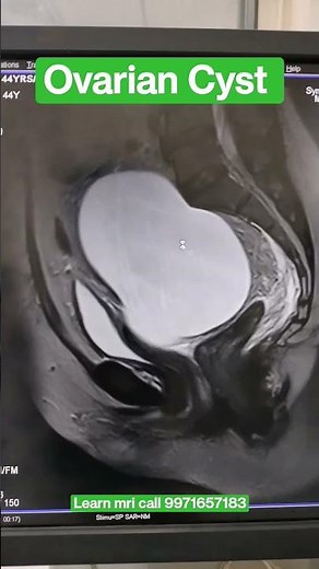 Pelvis MRI